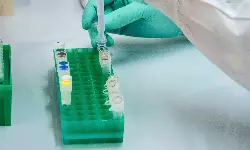 Jeena Criticare bags Good Distribution Practices (GDP) certification Jeena Criticare bags Good Distribution Practices (GDP) certification