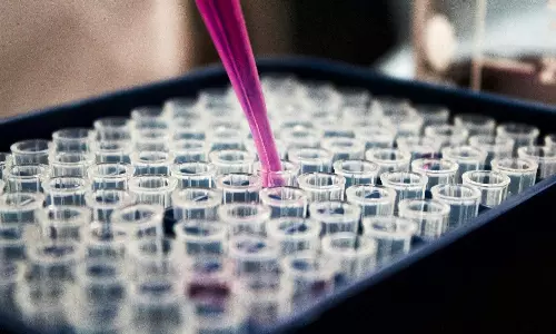 Pharma supply chains are performing, but not yet optimised