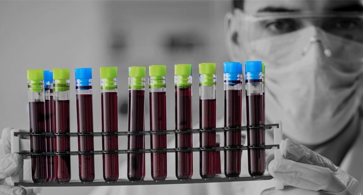 WoW Express taps niche segment of diagnostics logistics WoW Express taps niche segment of diagnostics logistics
